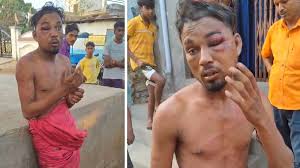 Dalit teen brutally beaten up for touvhing water in UP