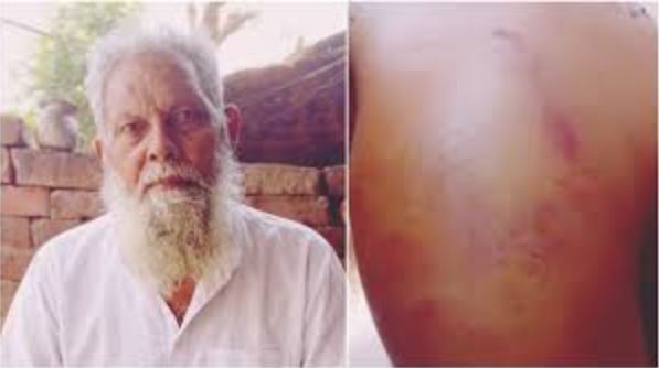 ‘Go to Pakistan’, Muslim elderly man brutally assaulted, robbed in UP